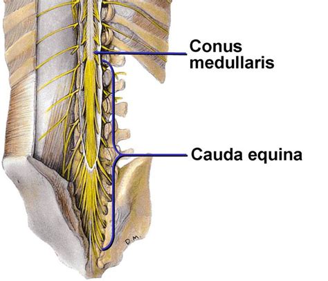 difference between conus medullaris and cauda equina|conus medullaris and filum terminale.